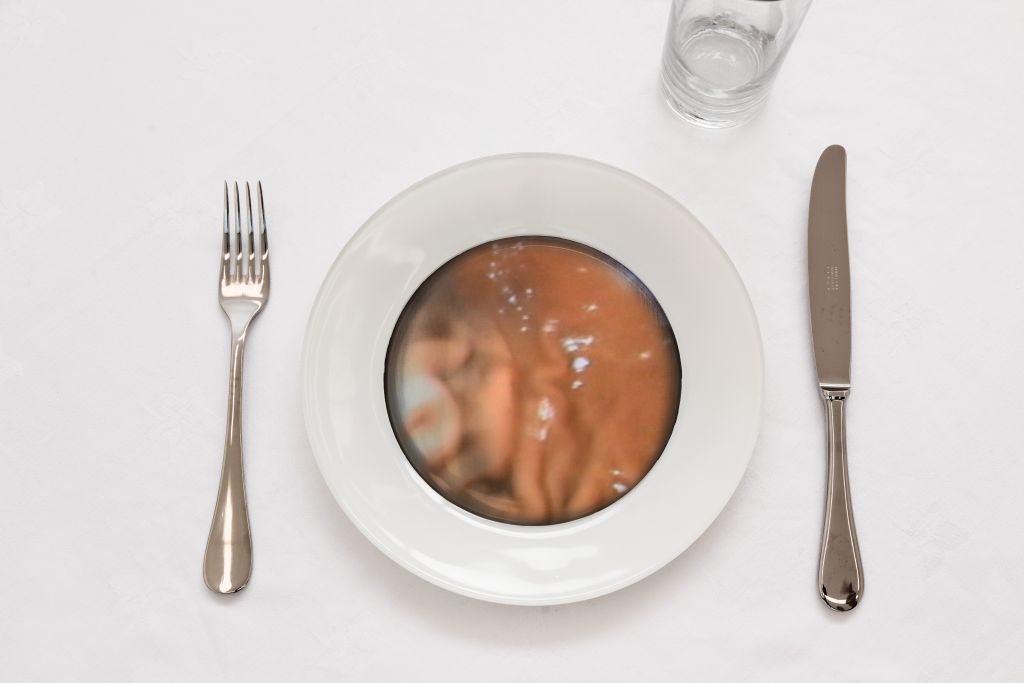 Auf einem weißen Tischtuch steht ein Teller. In den Boden des Tellers ist ein Bildschirm eingelassen, der eine Innenansicht eines Darms zeigt.