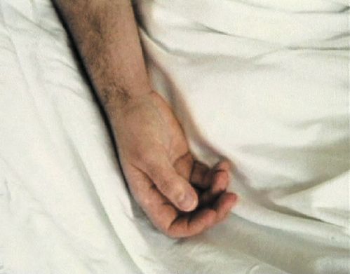 The right hand of a person lies on a white bed sheet.