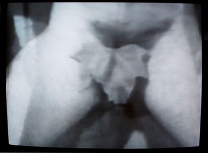 Black and white illustration. A fig leaf covers the genital area of a person