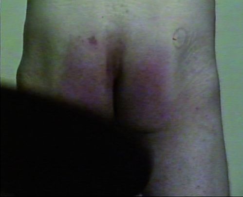 Video-Screenshot: ein nackter männlicher Hintern mit auffälliger Hautrötung teilweise bedeckt von dem Schatten eines nicht erkennbaren Gegenstands