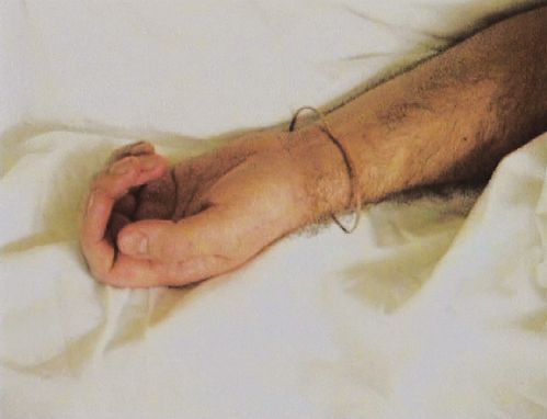 The left hand of a person lies on a white bed sheet.